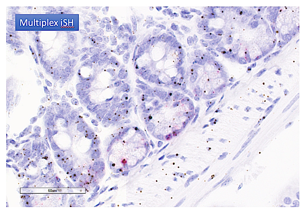 Immunohistochemistry and in situ Hybridization | UK Healthcare